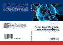 Prostate Cancer Classification using Multispectral Images
