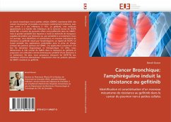 Cancer Bronchique: L'Amphiréguline Induit La Résistance Au Gefitinib - Busser, Benoît