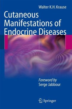 Cutaneous Manifestations of Endocrine Diseases - Krause, Walter K.H.