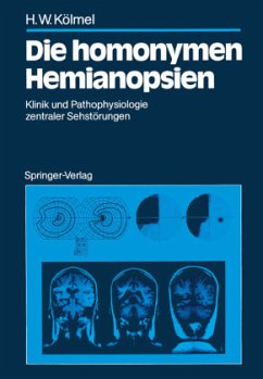 Die homonymen Hemianopsien - Kölmel, Hans W.