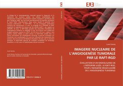 IMAGERIE NUCLEAIRE DE L¿ANGIOGENÈSE TUMORALE PAR LE RAFT-RGD - Sancey, Lucie