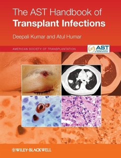 The Ast Handbook of Transplant Infections - Kumar, Deepali; Humar, Atul