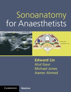 Sonoanatomy for Anaesthetists - Lin, Edward; Gaur, Atul; Jones, Michael; Ahmed, Aamer