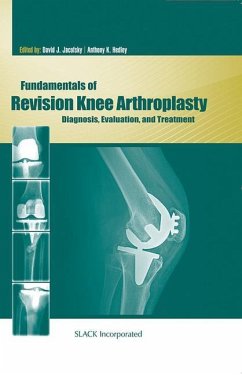 Fundamentals of Revision Knee Arthroplasty - Jacofsky, David; Hedley, Anthony