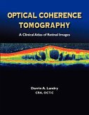 Optical Coherence Tomography a Clinical Atlas of Retinal Images