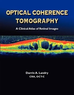 Optical Coherence Tomography a Clinical Atlas of Retinal Images - Landry, Darrin A.