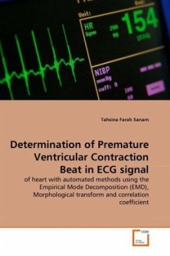 Determination of Premature Ventricular Contraction Beat in ECG signal