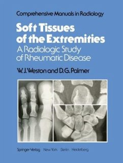 Soft Tissues of the Extremities - Weston, W. J.;Palmer, D. G.