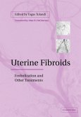 Uterine Fibroids