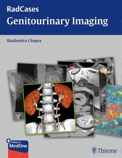 Radcases Genitourinary Imaging - Chopra, Shailendra
