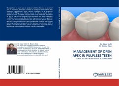 MANAGEMENT OF OPEN APEX IN PULPLESS TEETH