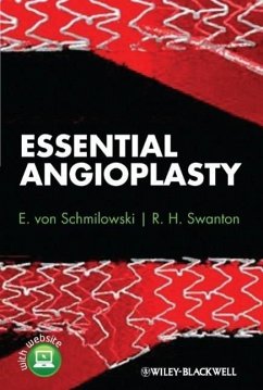 Essential Angioplasty - Schmilowski, E. von; Swanton, R. H.