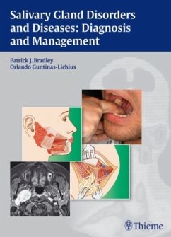 Salivary Gland Disorders and Diseases - Bradley, Patrick J.;Guntinas-Lichius, Orlando