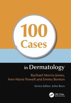 100 Cases in Dermatology - Morris-Jones, Rachael (PhD PCME FRCP Consultant Dermatologist & Hono; Powell, Ann-Marie (Consultant Dermatologist, Department of Dermatolo; Benton, Emma (MB ChB MRCP Post-CCT Clinical Research Fellow, St John