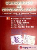 Punción aspiración con aguja fina en el diagnósitco de los tumores de los tejidos blandos