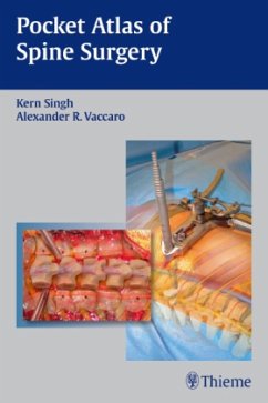 Pocket Atlas of Spine Surgery