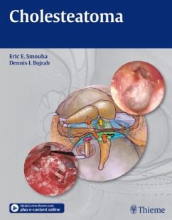 Cover Cholesteatoma