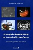 Urologische Begutachtung im Arzthaftpflichtverfahren