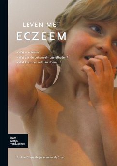 Leven Met Eczeem - Dirven-Meyer, P.E.;de Groot, Anton C.