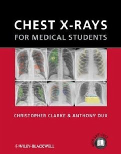 Chest X-Rays for Medical Students - Clarke, Christopher; Dux, Anthony