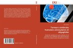 Tumeurs cérébrales humaines astrocytaires et oligogliales