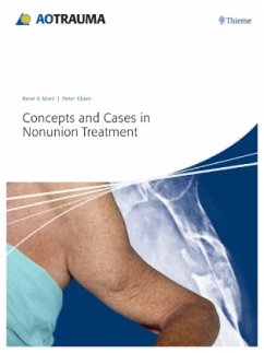Concepts and Cases in Nonunion Treatment - Marti, René K.;Kloen, Peter