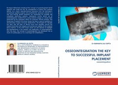 OSSEOINTEGRATION THE KEY TO SUCCESSFUL IMPLANT PLACEMENT - Lal Gupta, Kanhaiya