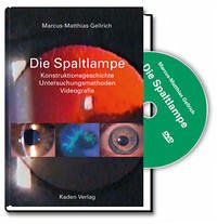 Die Spaltlampe - Gellrich, Marcus-Matthias