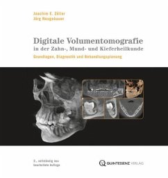 Digitale Volumentomografie in der Zahn-, Mund- und Kieferheilkunde - Zöller, Joachim E.;Neugebauer, Jörg