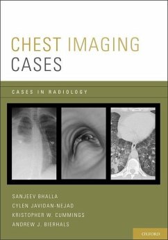 Chest Imaging Cases - Bhalla, Sanjeev; Javidan-Nejad, Cylen; Cummings, Kristopher W; Bierhals, Andrew J