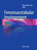 Femoroacetabular Impingement Femoroacetabular Impingement