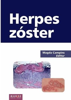 Herpes zóster - Campins, Magda