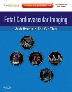 Fetal Cardiovascular Imaging - Rychik, Jack; Tian, Zhiyun