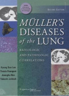 Muller's Diseases of the Lung - Lee, Kyung Soo