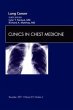Lung Cancer, an Issue of Clinics in... - Bild 1