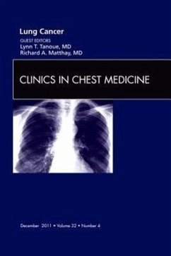 Lung Cancer, an Issue of Clinics in Chest Medicine - Tanoue, Lynn T; Matthay, Richard A