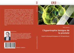 L''hypertrophie bénigne de la prostate - Jamoussi, Najib