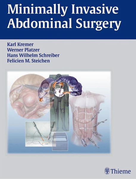 Minimally Invasive Abdominal Surgery (eBook, PDF)