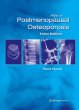Atlas of Postmenopausal Osteoporosis - Bild 1