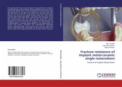 Fracture resistance of implant metal-ceramic single restorations