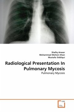 Radiological Presentation In Pulmonary Mycosis - Anwar, Shafiq;Mohsin Khan, Mohammad;Siddiqui, Mustafa