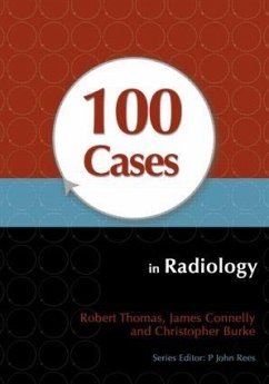 100 Cases in Radiology - Thomas, Robert (Specialist Registrar, Guyâ s and St Thomasâ Hospi; Connelly, James (Specialist Registrar, Guyâ s and St Thomasâ Hosp; Burke, Christopher (Specialist Registrar, Guyâ s and St Thomasâ H