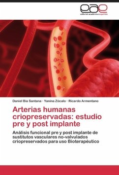 Arterias humanas criopreservadas: estudio pre y post implante - Bia Santana, Daniel;Zócalo, Yanina;Armentano, Ricardo