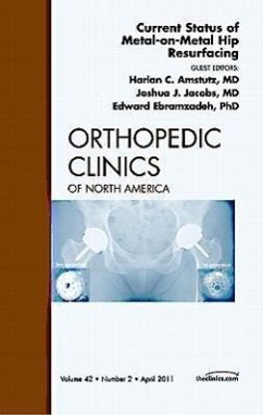 Current Status of Metal-On-Metal Hip Resurfacing, an Issue of Orthopedic Clinics - Amstutz, Harlan; Jacobs, Joshua; Ebramzadeh, Eddie