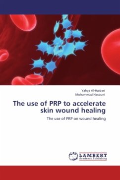 The use of PRP to accelerate skin wound healing - Al-Haideri, Yahya;Hasouni, Mohammad