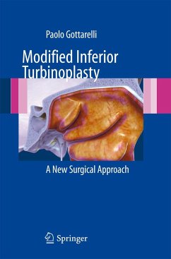 Modified Inferior Turbinoplasty - Gottarelli, Paolo