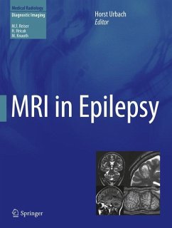 MRI in Epilepsy