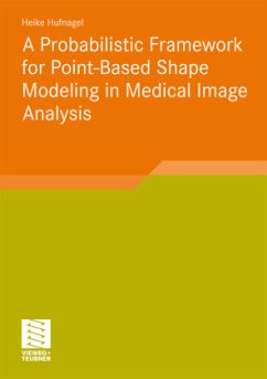 A Probabilistic Framework for Point-Based Shape Modeling in Medical Image Analysis - Hufnagel, Heike