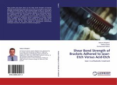 Shear Bond Strength of Brackets Adhered to laser-Etch Versus Acid-Etch
