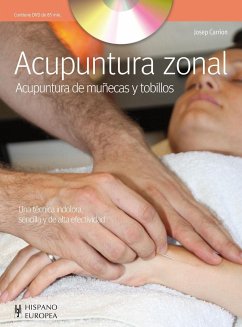 Acupuntura zonal - Carrión Milán, Josep